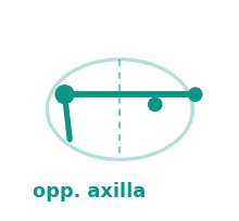 Opposite axilla