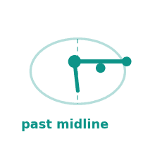 Past midline